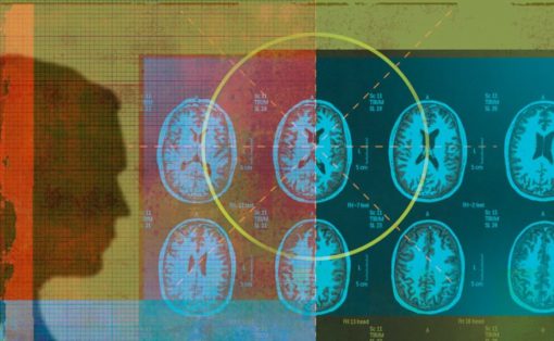 紐約大學和Facebook合作利用AI技術改善MRI掃描速度